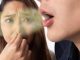 People are keeping distance from you because of bad breath? Try these home remedies