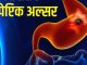 4 habits will rot the small intestine inside, risk of cancer due to peptic ulcer! go to the doctor immediately