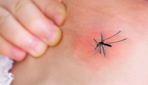 Dengue: Be alert to these symptoms of dengue, know how to avoid it