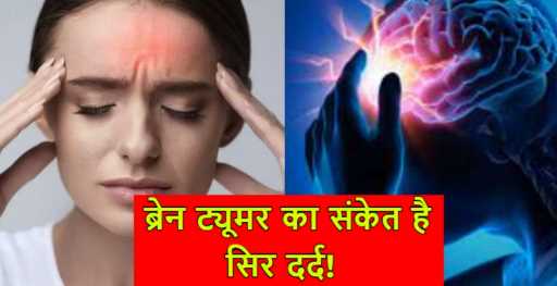Headache Symptoms: Do not ignore this type of headache, there can be signs of some serious illness!