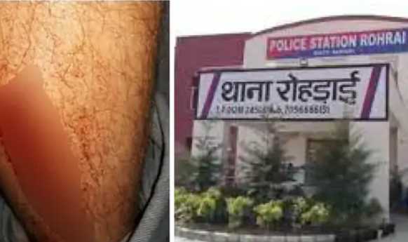 Policeman attacked in Haryana: The team had reached the house of the person who did not pay the fine for electricity theft; attacked with jelly