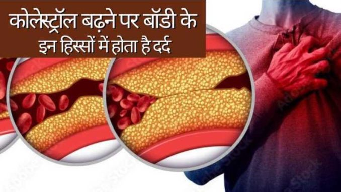 Severe pain in these parts of the body? Understand that cholesterol has increased