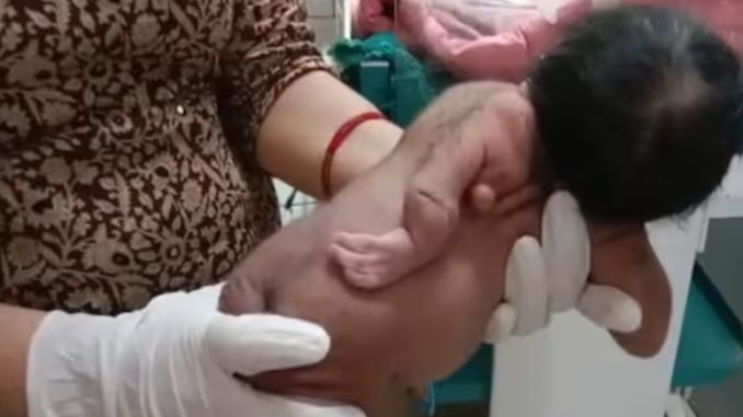 Rajasthan: Unique child with 3 hands born in Hanumangarh, third hand on back