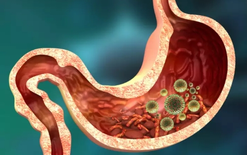 These 5 things eaten daily fill the intestines with toxins, one is 'sweet poison'
