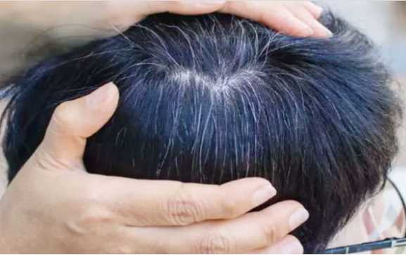 Due to the deficiency of this vitamin, white hair comes on the head, the feeling of old age starts at an early age.