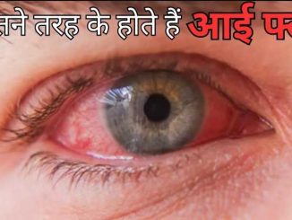 Cases of eye flu are increasing rapidly in the country, know its types and prevention from experts