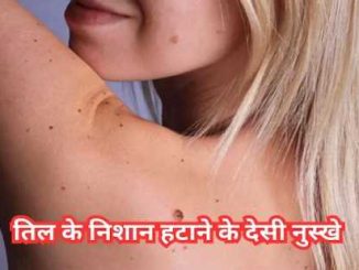 Mole marks will disappear overnight without surgery, follow these home remedies