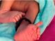 A girl with 26 fingers was born in the village of Bharatpur, even the doctors were surprised; know everything