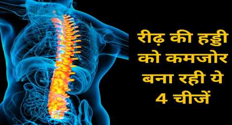 Weak Bones: These 4 things are making the spine weak, improve them immediately