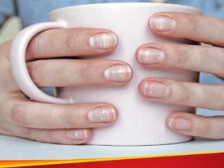 Signs of Vitamin B12 deficiency are also found in nails, know how to identify them.