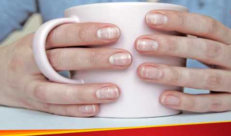 Signs of Vitamin B12 deficiency are also found in nails, know how to identify them.