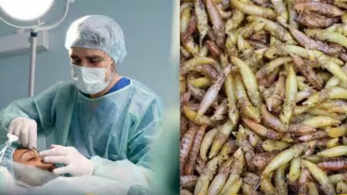 Doctors removed 150 live worms from the patient's nose, know the whole shocking story here