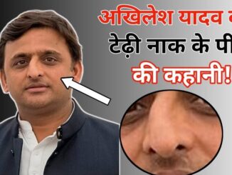 'Why is Akhilesh Yadav's nose crooked'... do you know? The reason behind this is interesting