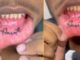 A boy crazy in love got his girlfriend's name tattooed inside his lips, you will also be shocked after watching the video