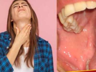 Try to stop the growth of tonsils in the throat before it starts, identify the initial symptoms of the disease in this way