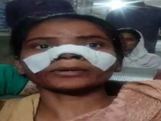 In Chhattisgarh, miscreants cut off a girl's nose: Seeing her grandfather and father being beaten, the girl who came to save her was brutally treated.