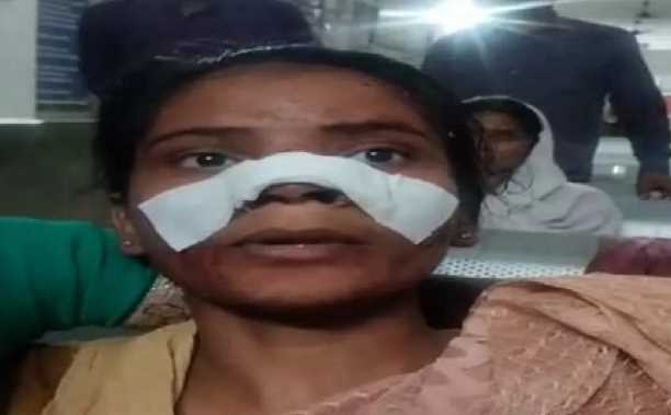In Chhattisgarh, miscreants cut off a girl's nose: Seeing her grandfather and father being beaten, the girl who came to save her was brutally treated.