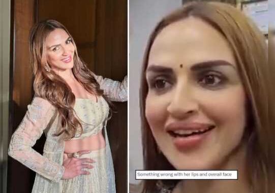 Did Esha Deol get lip surgery done? Seeing the new look, people said - 'I ate a lot of plastic...'
