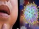 Mumps virus wreaks havoc in Rajasthan: Children affected in these districts