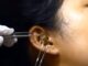 A snake entered a woman's ear while she was sleeping, even the doctor was shocked; watch the video