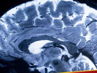 Brain scan was done with the world's most powerful MRI machine, mysterious parts of the brain seen in the picture