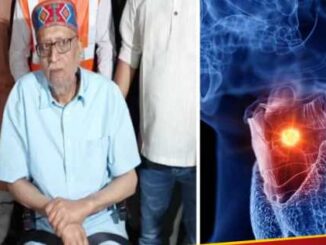 Sushil Kumar Modi suffering from throat cancer, cancer reached this deadly stage within 6 months