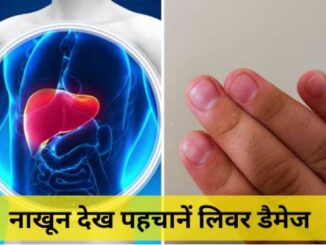 Liver Damage Sign: Liver damage can be detected by looking at the nails, these are the changes in color and shape.