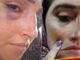 swollen eyes, cracked lips; How did Seema Haider get injured on her face? Know the truth of the viral video