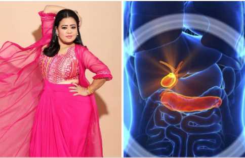The pain that Bharti Singh thought was indigestion turned out to be the problem of gallstones in the gall bladder, know how Gallbladder Stones occur?