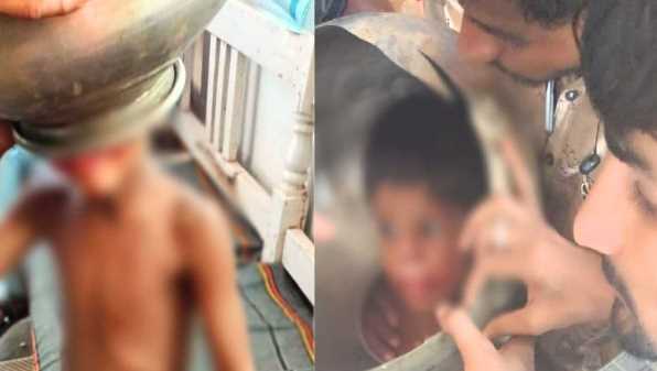 In Madhya Pradesh, an innocent child's head got stuck in a pot, he kept crying for hours, then his life was saved like this